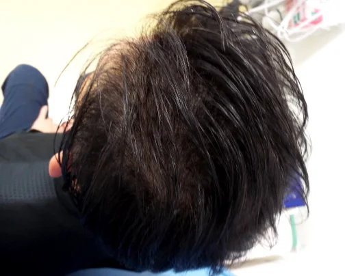 治療のビフォーアフター