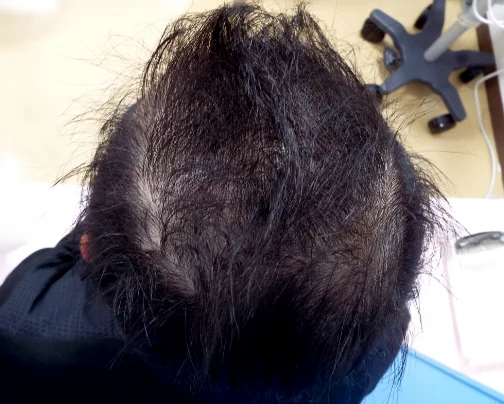 治療のビフォーアフター