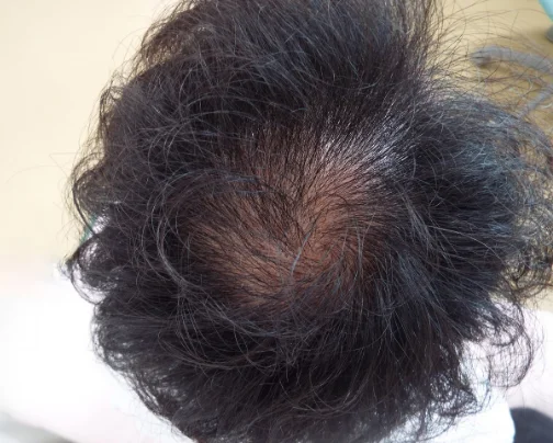 治療のビフォーアフター