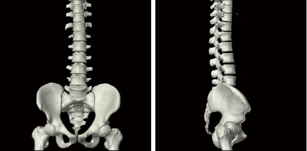 人間のレントゲン写真