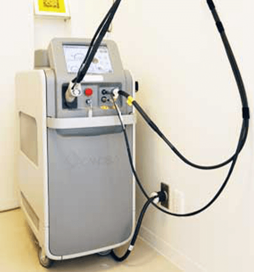 最新美容レーザー装置